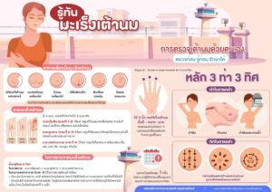 เต้านม A3